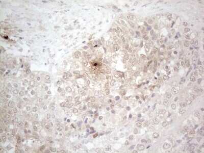 Immunohistochemistry: ASPA Antibody (OTI3G5) [NBP2-46549]