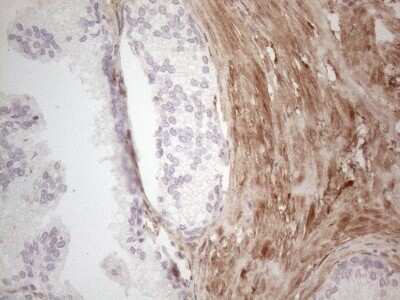 Immunohistochemistry: ASPA Antibody (OTI3G5) [NBP2-46549]
