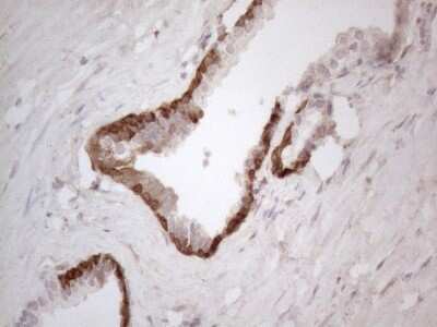 Immunohistochemistry: ASPA Antibody (OTI3G5) [NBP2-46549]