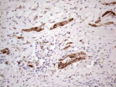 Immunohistochemistry: ASPA Antibody (OTI3G5) [NBP2-46549]