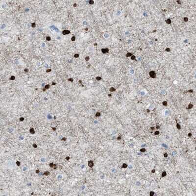 Immunohistochemistry-Paraffin: ASPA Antibody [NBP1-89258]