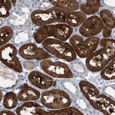 Immunohistochemistry-Paraffin: ASPA Antibody [NBP1-89258]