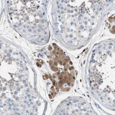 Immunohistochemistry-Paraffin: ASPA Antibody [NBP1-89258]