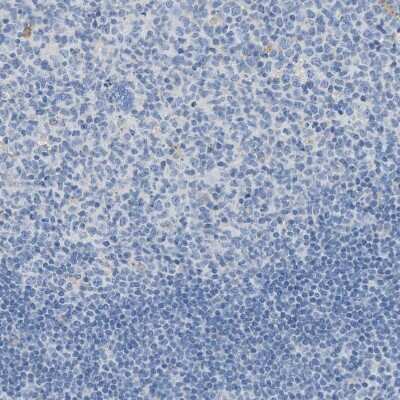 Immunohistochemistry-Paraffin: ASPA Antibody [NBP1-89258]