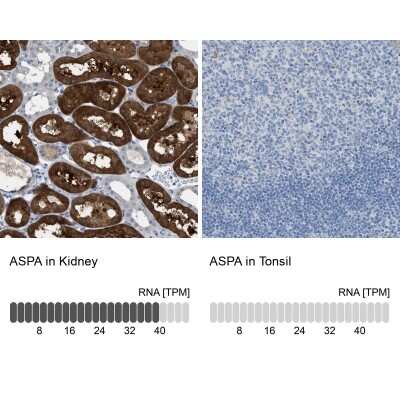 Immunohistochemistry-Paraffin: ASPA Antibody [NBP1-89258]
