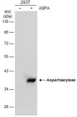 Western Blot: ASPA Antibody [NBP1-31754]