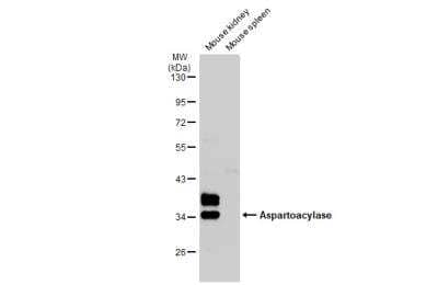 Western Blot: ASPA Antibody [NBP1-31754]