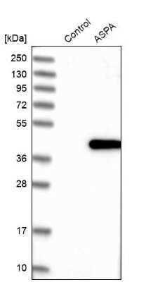 Western Blot: ASPA Antibody [NBP1-89258]