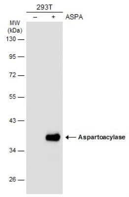 Western Blot: ASPA Antibody [NBP2-15491]