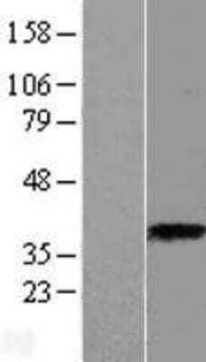 Western Blot: ASPA Overexpression Lysate [NBP2-09465]