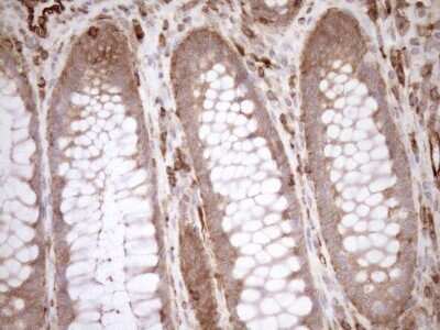Immunohistochemistry: ASPDH Antibody (OTI4G8) [NBP2-46550]