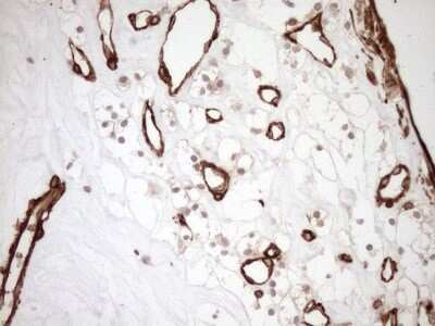 Immunohistochemistry: ASPDH Antibody (OTI4G8) [NBP2-46550]
