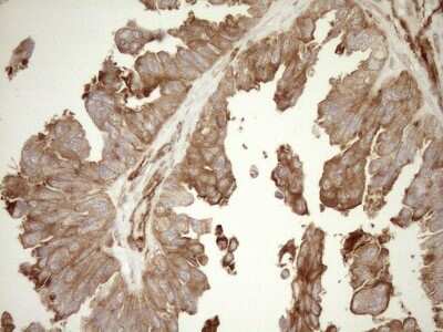 Immunohistochemistry: ASPDH Antibody (OTI4G8) [NBP2-46550]