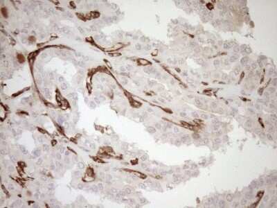 Immunohistochemistry: ASPDH Antibody (OTI4G8) [NBP2-46550]