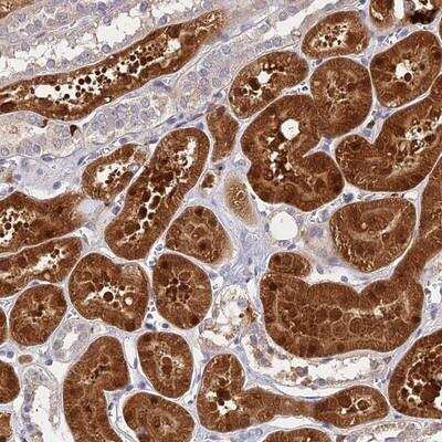 Immunohistochemistry: ASPDH Antibody [NBP1-86213]