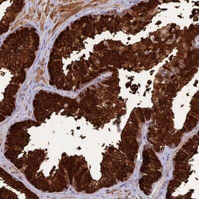 Immunohistochemistry-Paraffin: ASPDH Antibody [NBP1-85832]