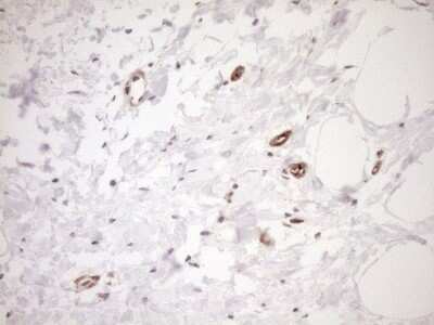 Immunohistochemistry: ASPDH Antibody (OTI4G8) - Azide and BSA Free [NBP2-72508]