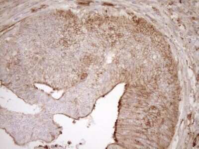 Immunohistochemistry: ASPDH Antibody (OTI4G8) - Azide and BSA Free [NBP2-72508]