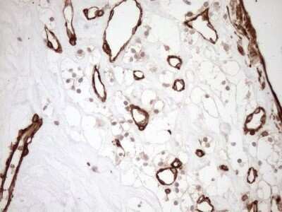 Immunohistochemistry: ASPDH Antibody (OTI4G8) - Azide and BSA Free [NBP2-72508]