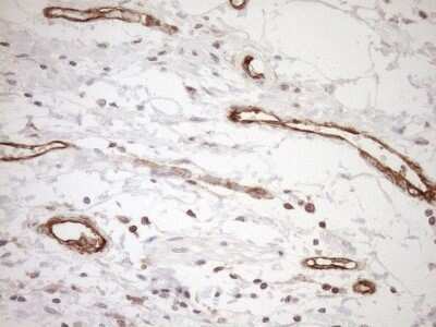 Immunohistochemistry: ASPDH Antibody (OTI4G8) - Azide and BSA Free [NBP2-72508]