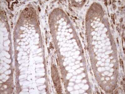Immunohistochemistry: ASPDH Antibody (OTI4G8) - Azide and BSA Free [NBP2-72508]