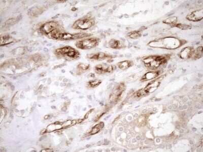 Immunohistochemistry: ASPDH Antibody (OTI4G8) - Azide and BSA Free [NBP2-72508]