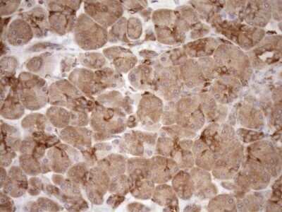 Immunohistochemistry: ASPDH Antibody (OTI4G8) - Azide and BSA Free [NBP2-72508]