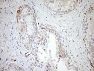 Immunohistochemistry: ASPDH Antibody (OTI4G8) - Azide and BSA Free [NBP2-72508]