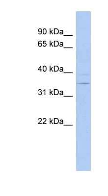 Western Blot: ASPDH Antibody [NBP1-56824]