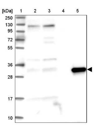 Western Blot: ASPDH Antibody [NBP1-85832]