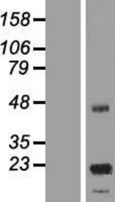 Western Blot: ASPDH Overexpression Lysate [NBL1-12619]