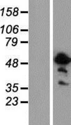 Western Blot: ASPHD2 Overexpression Lysate [NBP2-06651]