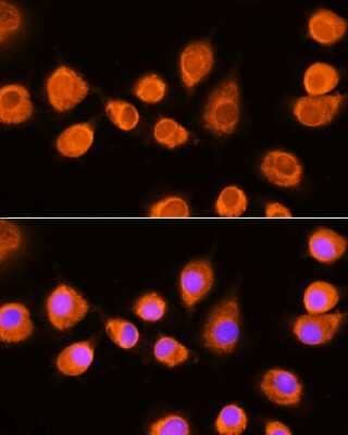 Immunocytochemistry/ Immunofluorescence: ASPM Antibody - Azide and BSA Free [NBP2-92395]