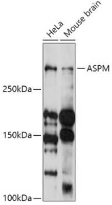 Western Blot: ASPM AntibodyAzide and BSA Free [NBP2-92395]