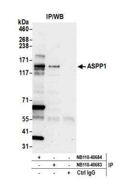Immunoprecipitation: ASPP1 Antibody [NB110-40684]