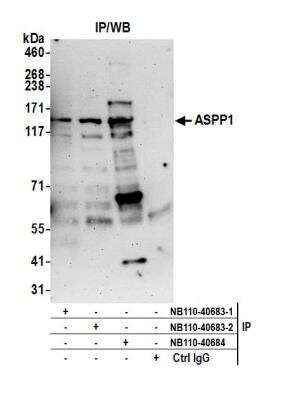 Immunoprecipitation: ASPP1 Antibody [NB110-40683]