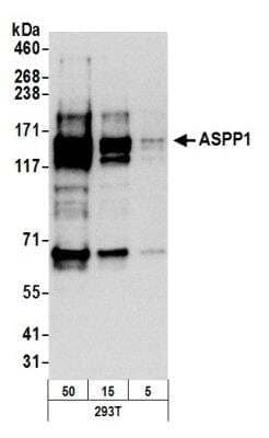 Western Blot: ASPP1 Antibody [NB110-40684]