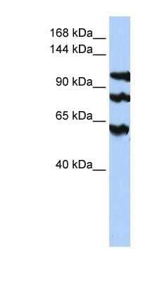 Western Blot: ASPP1 Antibody [NBP1-59093]