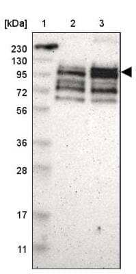 Western Blot: ASPP1 Antibody [NBP1-90078]