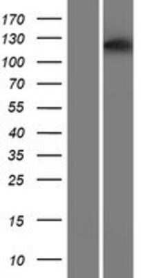 Western Blot: ASPP1 Overexpression Lysate [NBP2-10288]