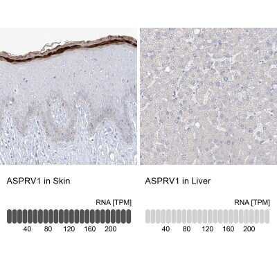 Immunohistochemistry-Paraffin: ASPRV1 Antibody [NBP1-83570]