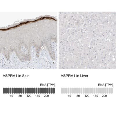 Immunohistochemistry-Paraffin: ASPRV1 Antibody [NBP2-33981]