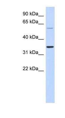 Western Blot: ASPRV1 Antibody [NBP1-56511]