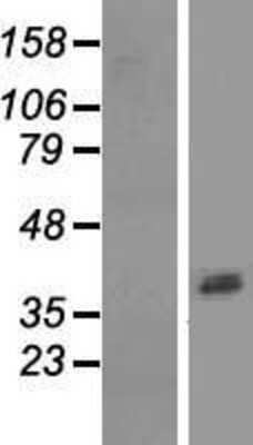 Western Blot: ASPRV1 Overexpression Lysate [NBL1-07775]