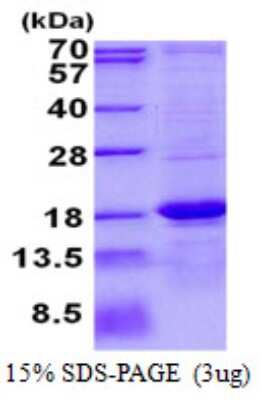 SDS-PAGE: Recombinant Human ASPRV1 His Protein [NBP2-22698]