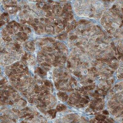 Immunohistochemistry: ASRGL1 Antibody (CL1679) [NBP2-42378]