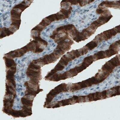 Immunohistochemistry: ASRGL1 Antibody (CL1679) [NBP2-42378]