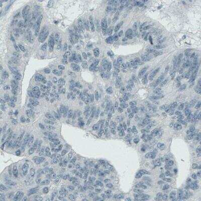 Immunohistochemistry: ASRGL1 Antibody (CL1679) [NBP2-42378]