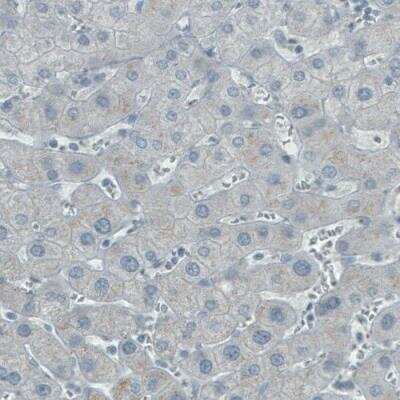 Immunohistochemistry: ASRGL1 Antibody (CL1679) [NBP2-42378]