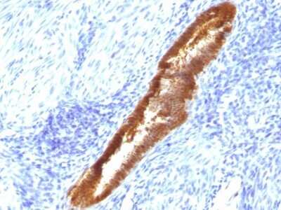 Immunohistochemistry-Paraffin: ASRGL1 Antibody (CRASH/1289) - Azide and BSA Free [NBP2-54450]
